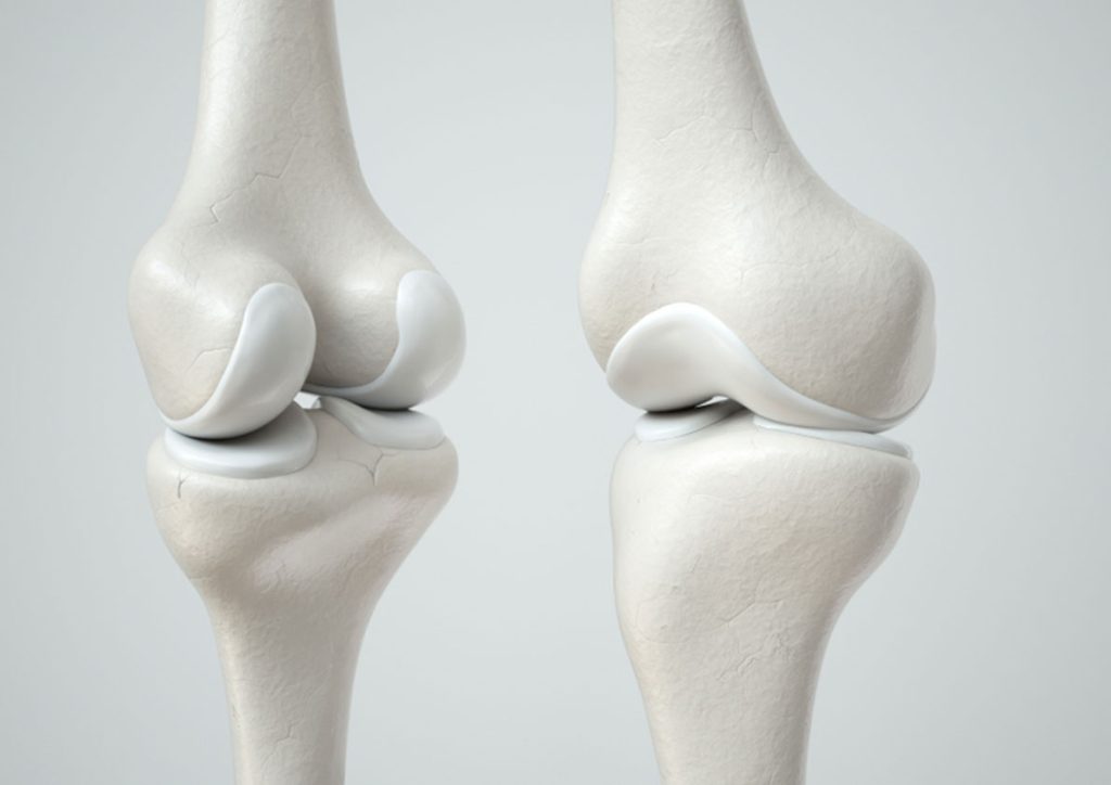 Do-you-love-your-bones_blog-thumb